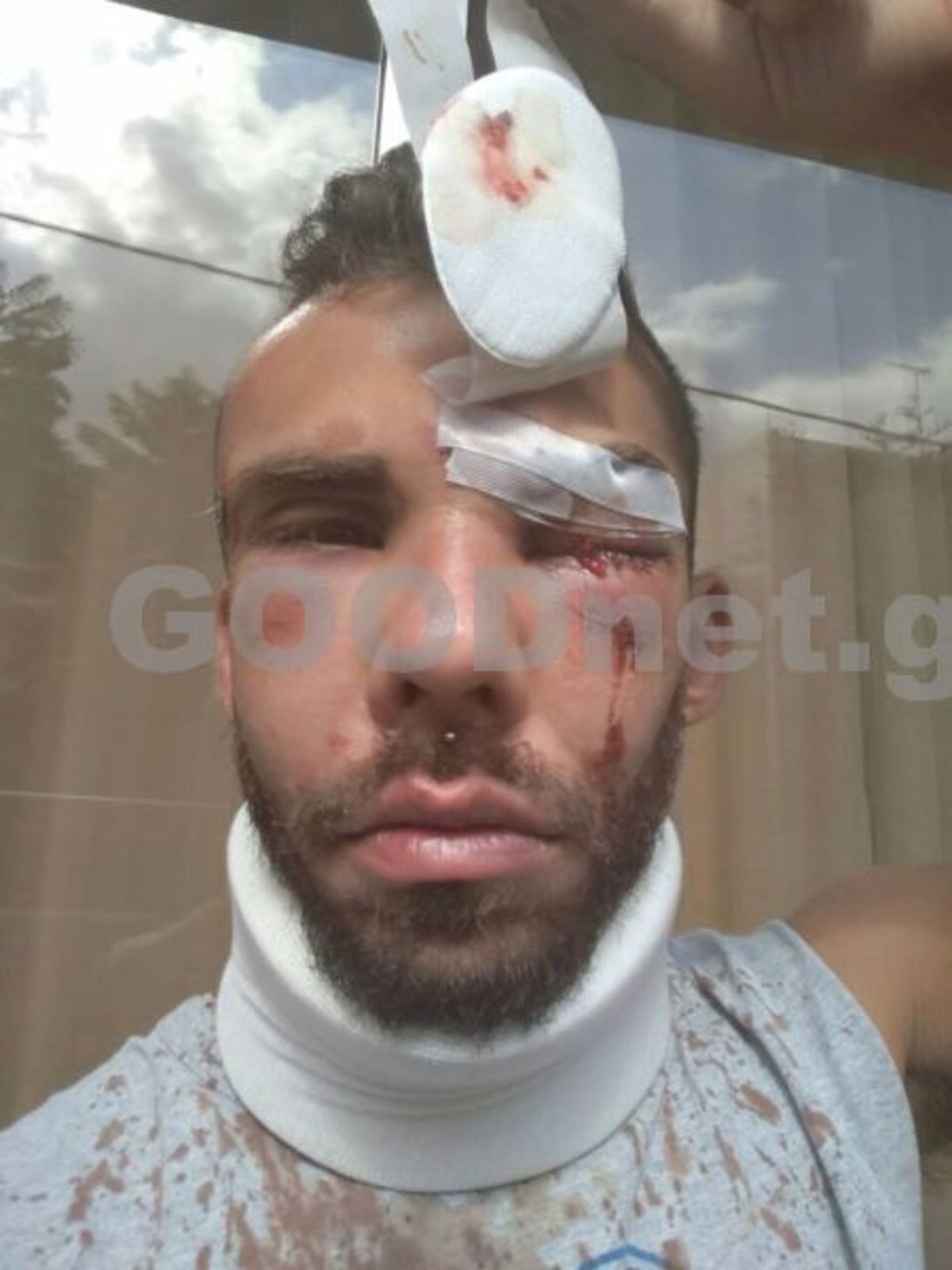 Δολοφονική επίθεση σε 30χρονο στην Κρήτη! “Με χτυπούσαν ανελέητα”!