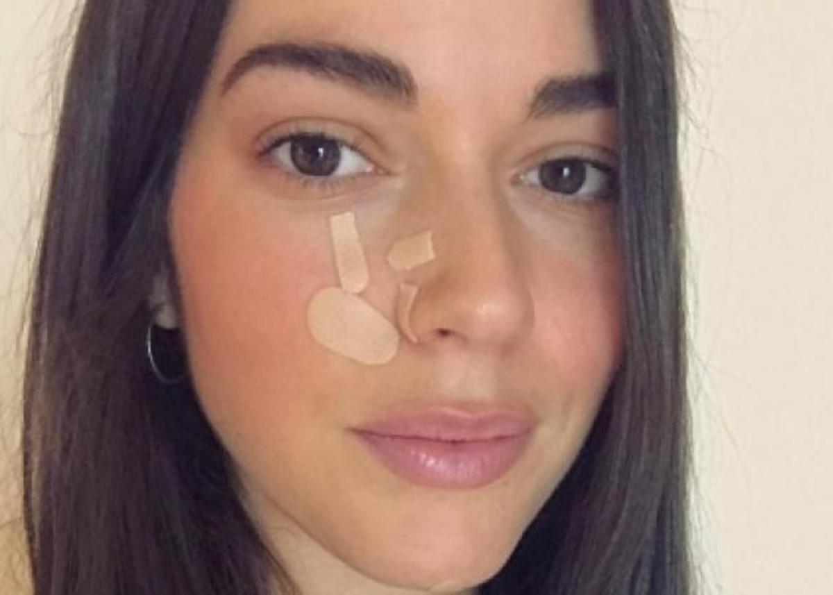 Ισμήνη Νταφοπούλου: Πώς είναι σήμετα το πρόσωπό της, μετά τον σοβαρό τραυματισμό στο πρόσωπο! [pics]