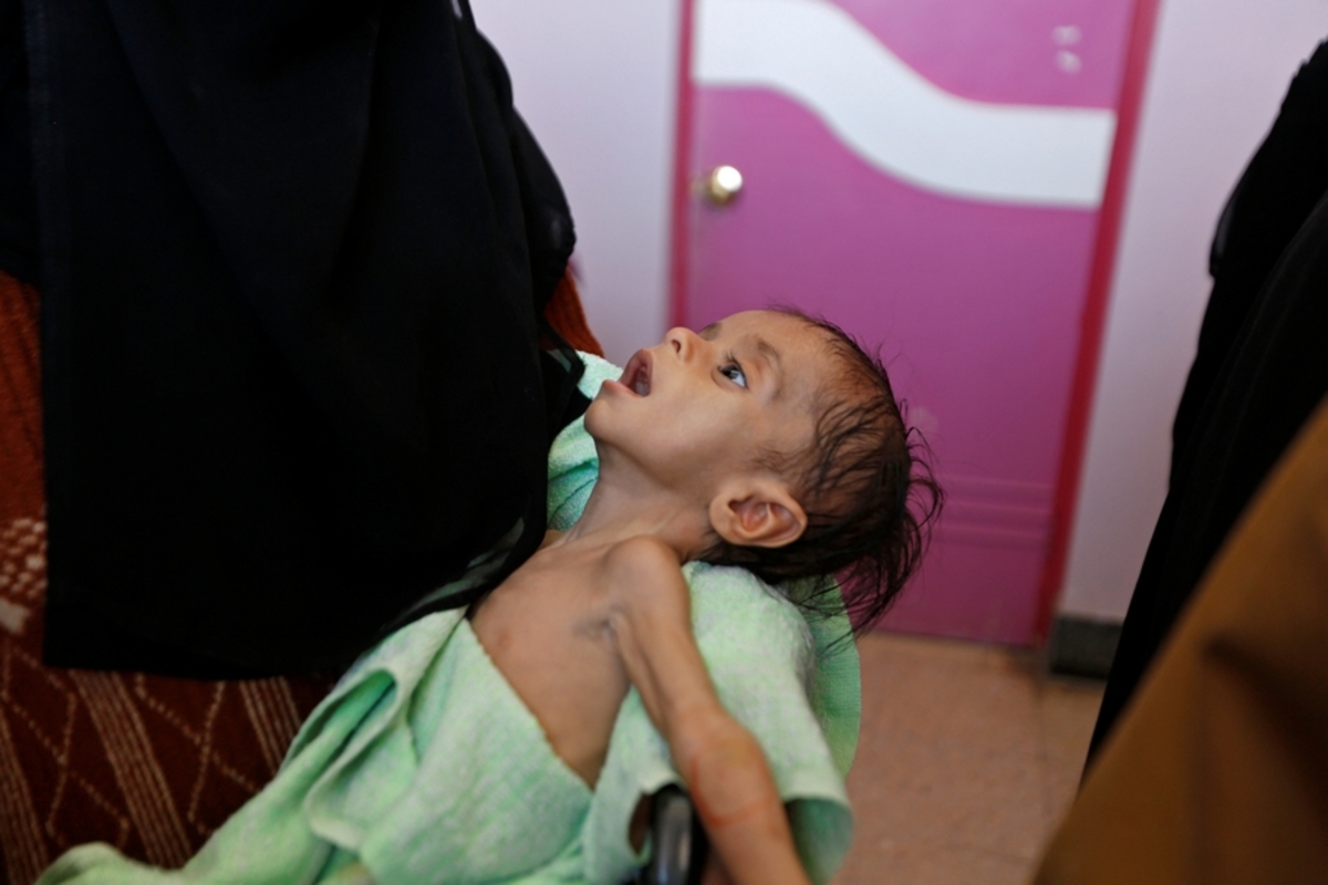 Φόβοι για χιλιάδες νεκρούς στην Υεμένη – 2,5 εκατομμύρια χωρίς πρόσβαση σε καθαρό νερό