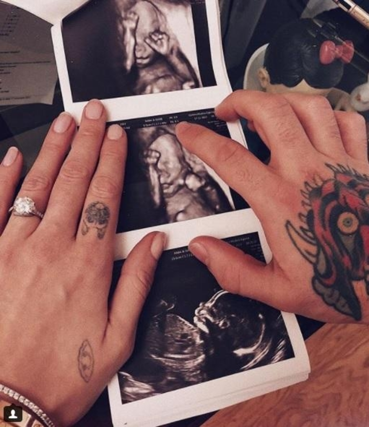 Διάσημη μέλλουσα μητέρα μας δείχνει το υπερηχογράφημα του μωρού της!