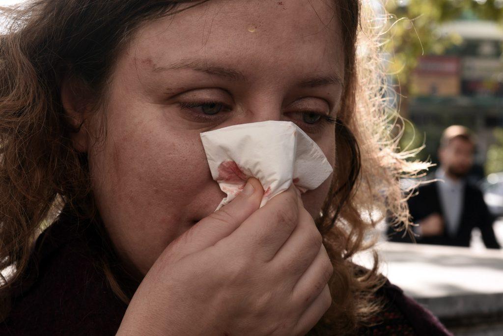 Ελεύθεροι οι 25 χρυσαυγίτες που προσήχθησαν για την επίθεση στις τρεις γυναίκες