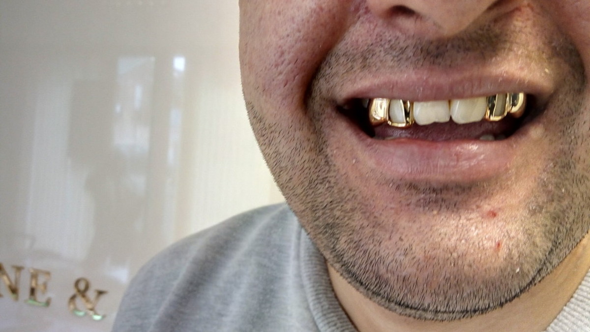 Στη φυλακή δημοτικός σύμβουλος που πρότεινε να βγάλουν τα χρυσά δόντια των Ρομά για… χρηματοδότηση!