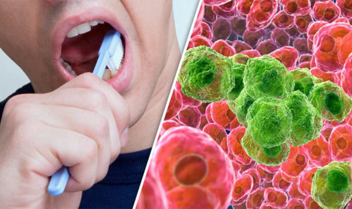 Ο καρκίνος του οισοφάγου συνδέεται με το βούρτσισμα των δοντιών – Δείτε τι συμβαίνει