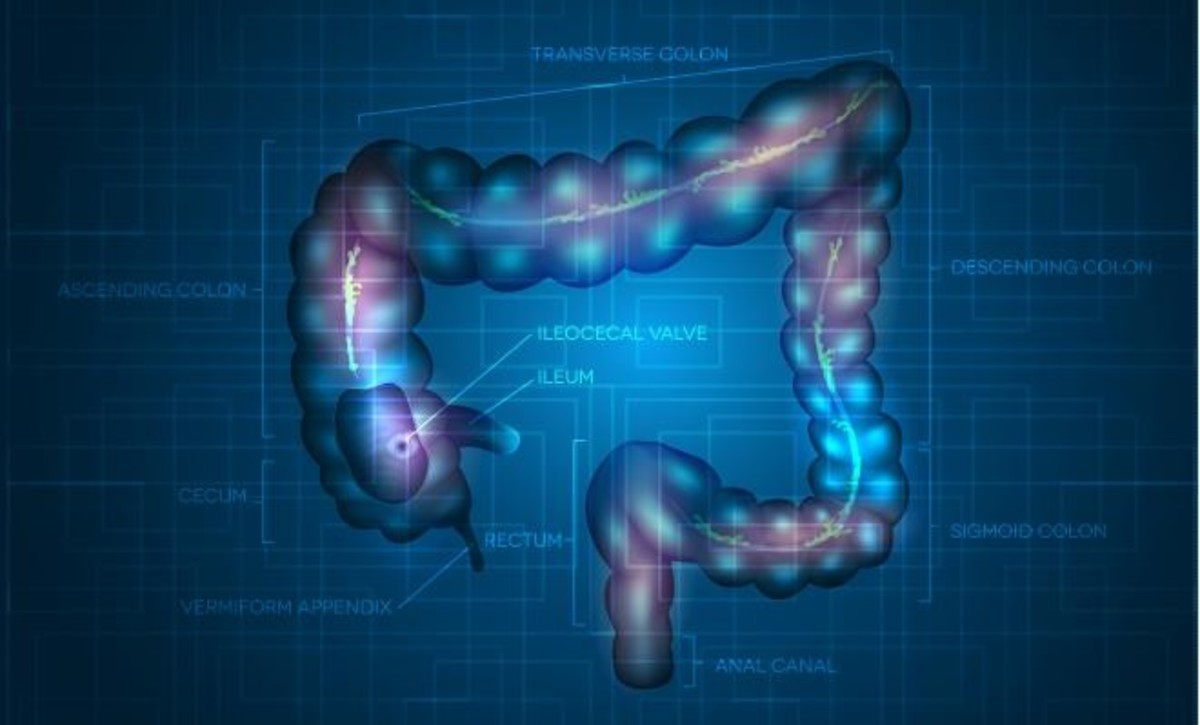 Καρκίνος του παχέος εντέρου: 4 τροφές που μειώνουν τον κίνδυνο