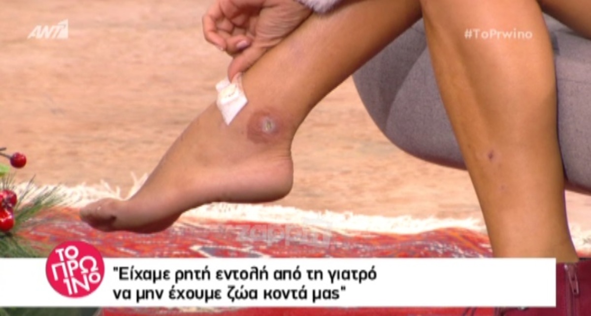 Σοκάρει η Αποστολία Ζώη: Μολύνθηκε από σταφυλόκοκκο!