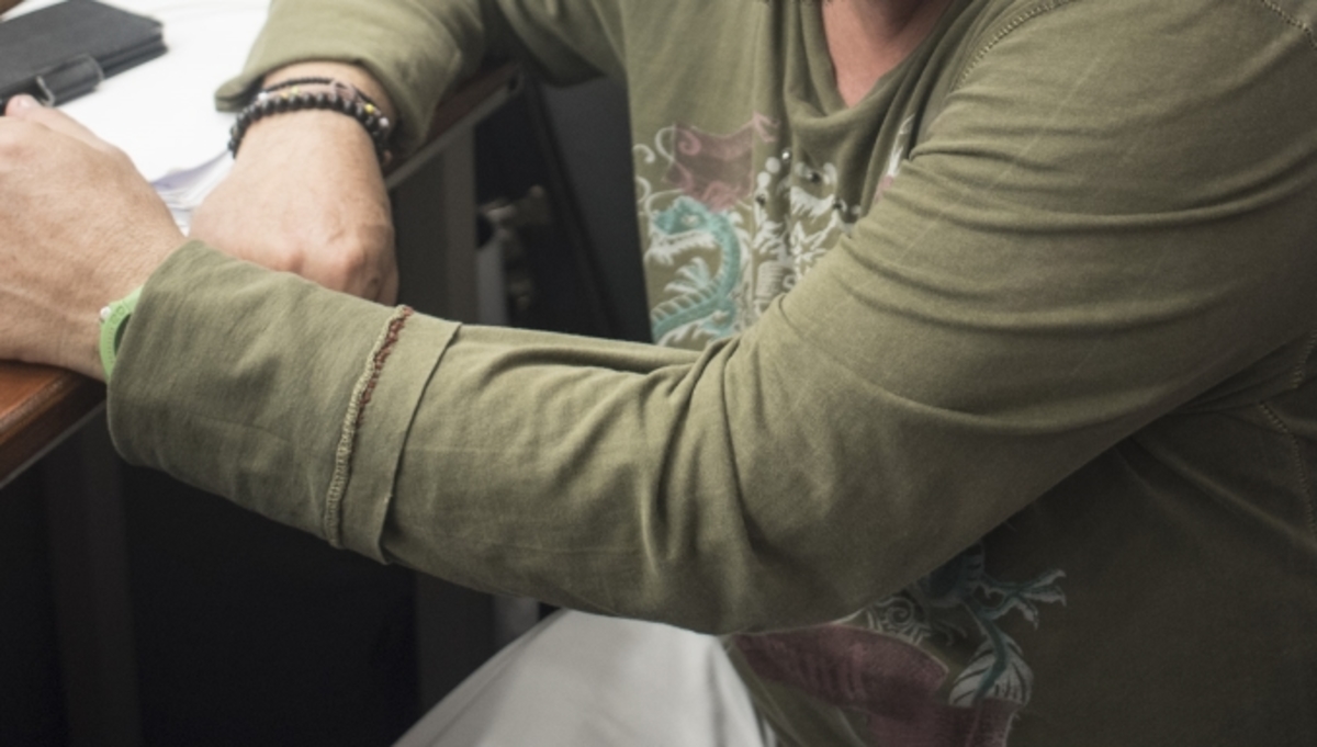 «Από τα 25 μου σχεδόν είμαι χωρίς μαλλιά, όταν μου πέφτανε…»