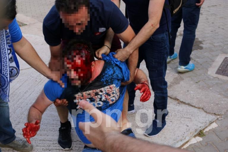 Μόνο ντροπή και οργή! Άνοιξαν κεφάλια σε αγώνα Γ’ Εθνικής στα Σπάτα [pics, vid] | Newsit.gr