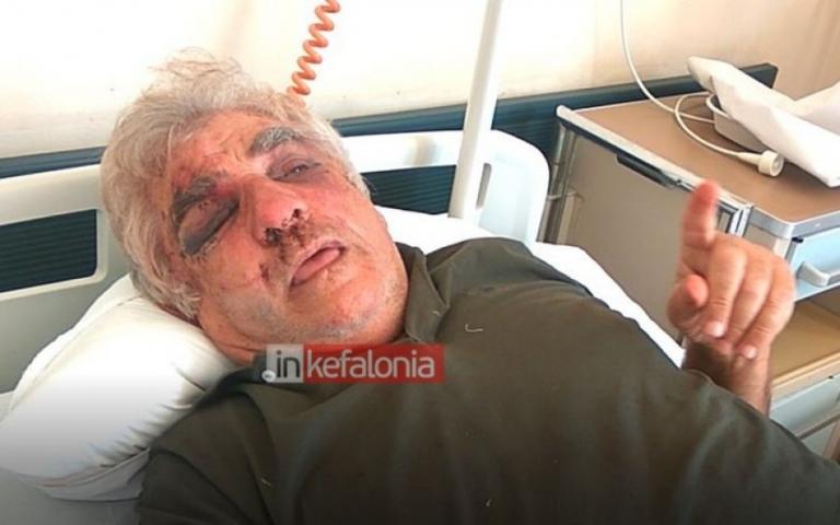 Κεφαλονιά: Οι ληστές παραμόρφωσαν το πρόσωπο γνωστού επιχειρηματία – Ληστεία κόλαση για την οικογένειά του – video | Newsit.gr Κεφαλονιά: Οι ληστές παραμόρφωσαν το πρόσωπο γνωστού επιχειρηματία – Ληστεία κόλαση για την οικογένειά του – video | Newsit.gr