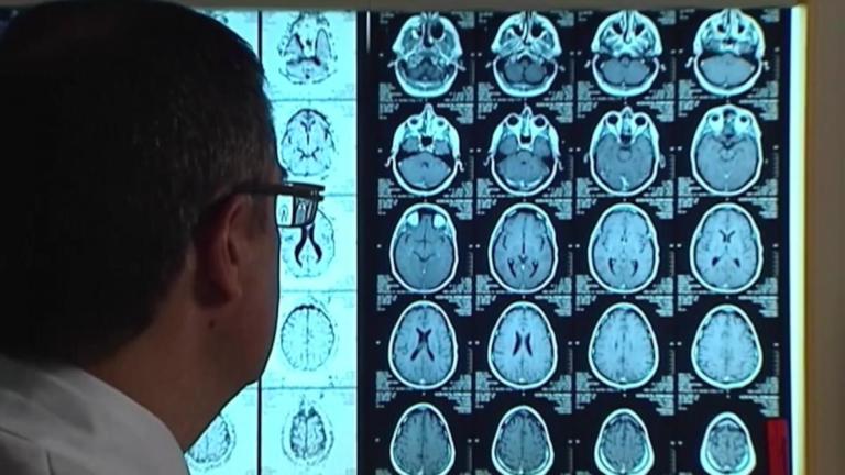 Αλτσχάιμερ: Μπορεί να μεταδοθεί από άνθρωπο σε άνθρωπο! | Newsit.gr Αλτσχάιμερ: Μπορεί να μεταδοθεί από άνθρωπο σε άνθρωπο! | Newsit.gr