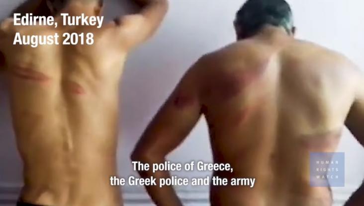 HRW: Εικονικές εκτελέσεις και βασανιστήρια σε πρόσφυγες στον Έβρο – Σοκάρουν οι μαρτυρίες | Newsit.gr HRW: Εικονικές εκτελέσεις και βασανιστήρια σε πρόσφυγες στον Έβρο – Σοκάρουν οι μαρτυρίες | Newsit.gr