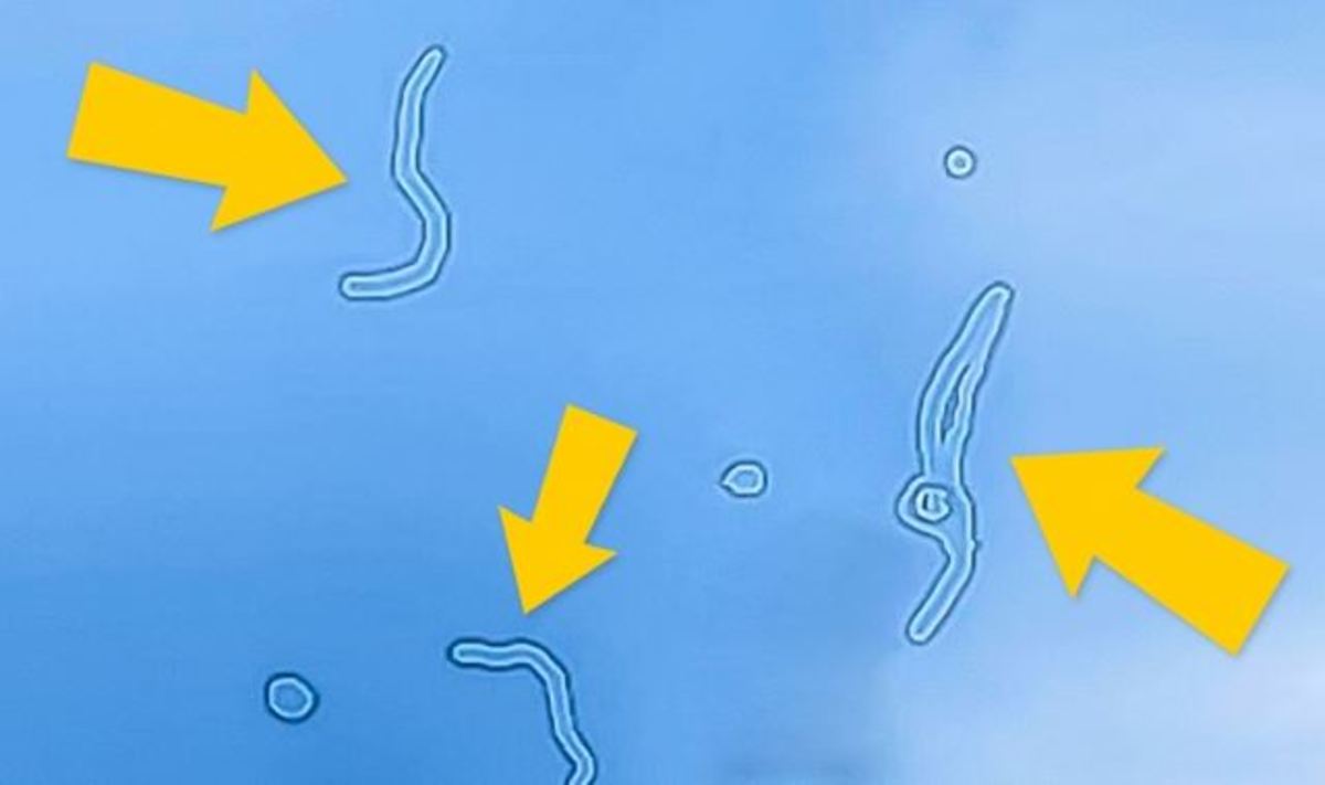 Τι είναι ΑΥΤΑ τα σημάδια που καμιά φορά… αιωρούνται στα μάτια σας [vid]