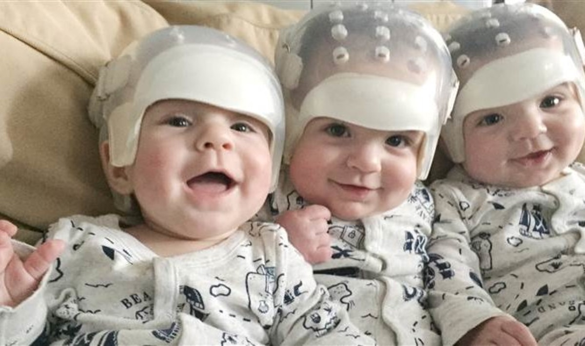 Αυτά είναι “τα πιο σπάνια τρίδυμα” στην ιστορία της Ιατρικής – Δείτε γιατί!
