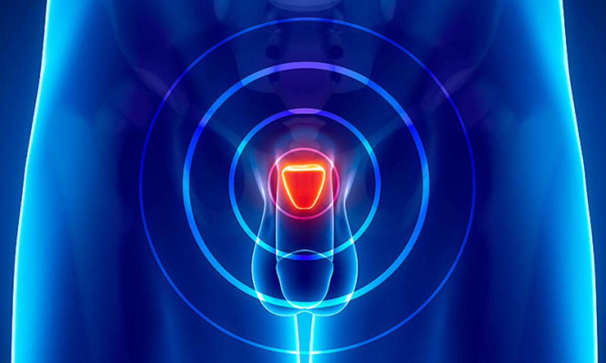 Ο προστάτης θέλει προσοχή: Κάθε πότε πρέπει να γίνεται εξέταση