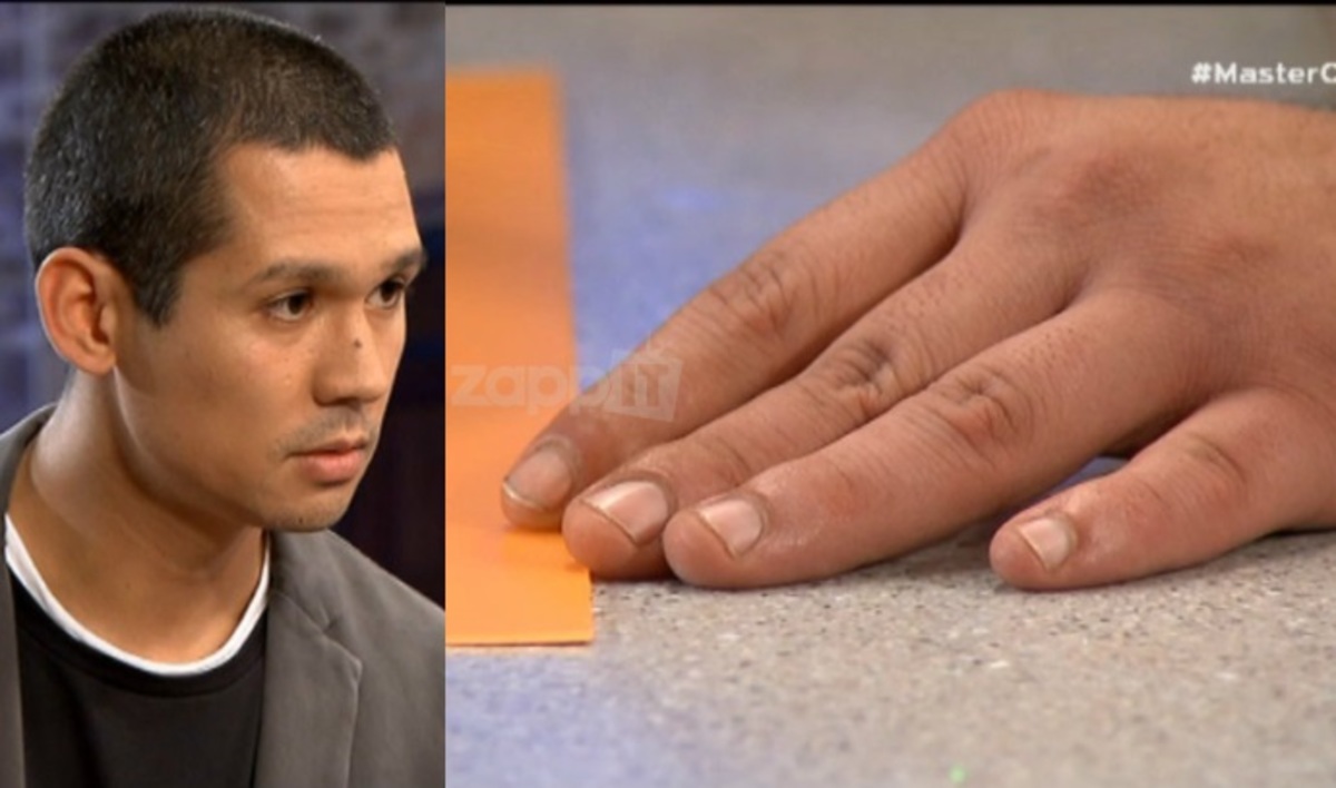 MasterChef: Εξοργισμένος ο Κοντιζάς με τον διαγωνιζόμενο! «Κοίτα τα δάχτυλά σου»!