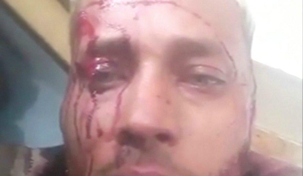Βενεζουέλα: Ο καταζητούμενος Όσκαρ Πέρες που εναντιωνόταν στην κυβέρνηση Μαδούρο σκοτώθηκε σε επιχείρηση της αστυνομίας