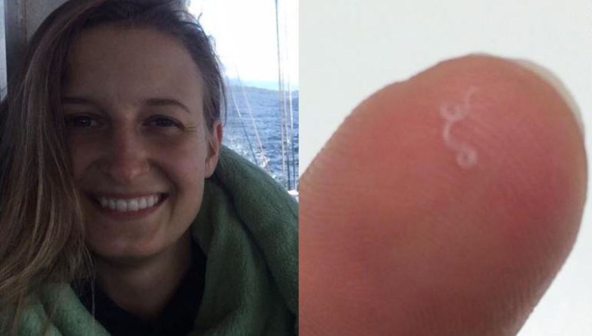 Κοιτάχτηκε στον καθρέφτη και είδε ένα σκουλήκι να κουνιέται μέσα στο μάτι της! [vid]