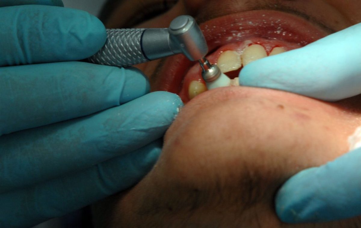 Κρήτη: Ο πόνος στο δόντι τον έστειλε στην εντατική – Πάγωσαν όταν πήραν στα χέρια τους την ακτινογραφία!