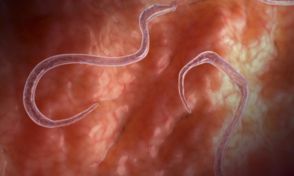 Προσοχή: Τα σημάδια που δείχνουν ότι μπορεί έχετε παράσιτα στο έντερο!