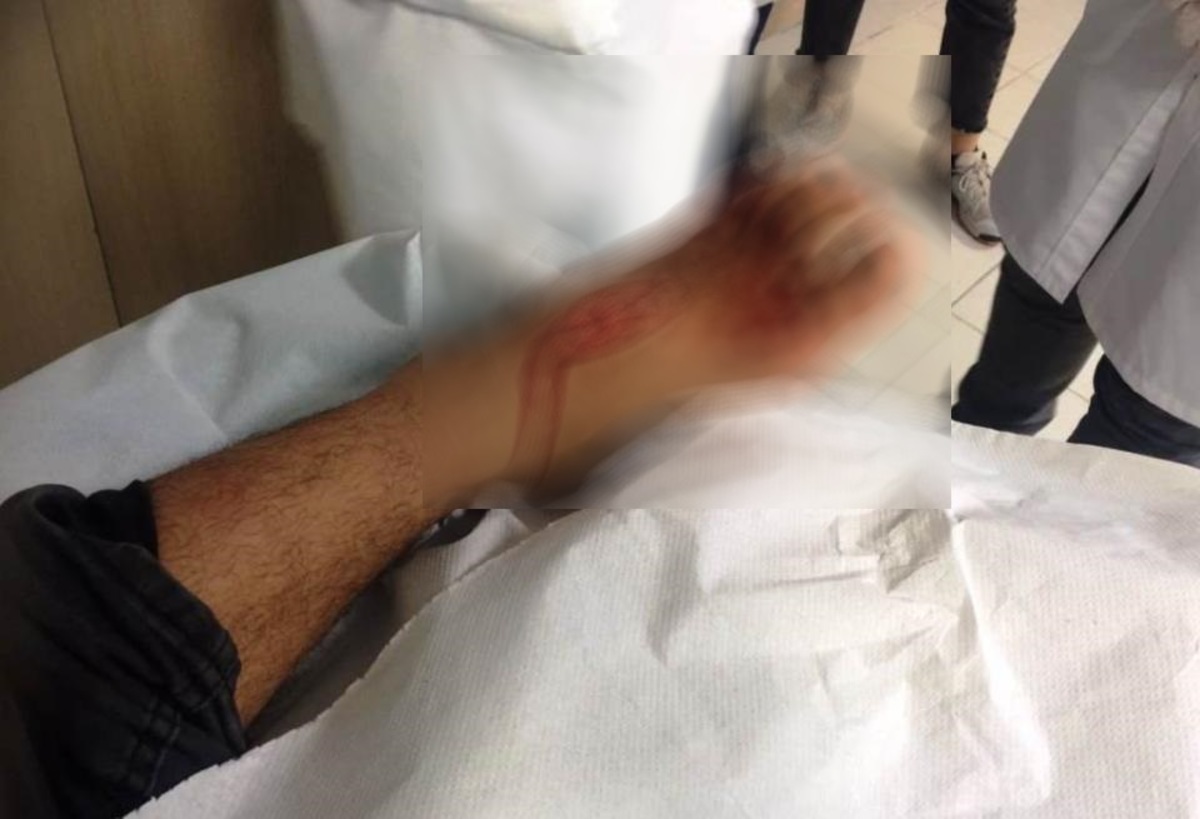 Πάτρα: “Λιμενικός μαχαίρωσε το προσφυγόπουλο” – Μήνυση από αλληλέγγυους [pics]