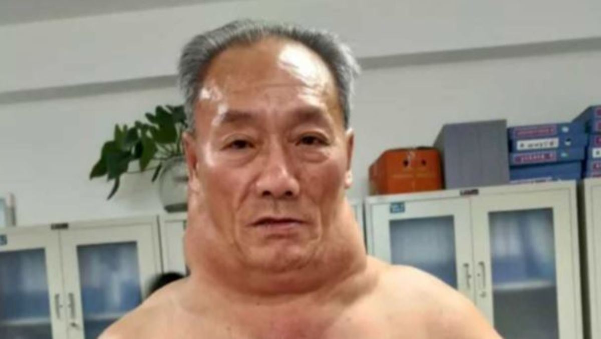 Έγινε ΕΤΣΙ επειδή έπινε τουλάχιστον 1 λίτρο κρασί την ημέρα επί 30 χρόνια! [pics, vid]