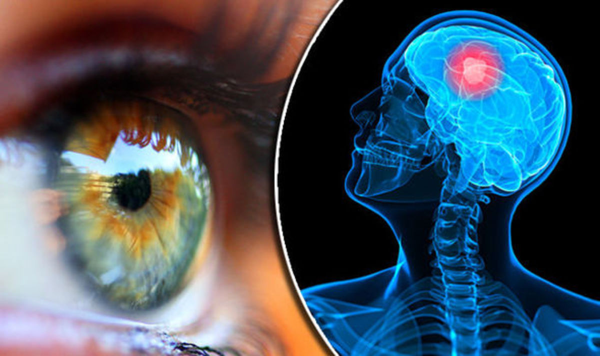 Με τεστ στα μάτια μπορεί να φανούν πέντε σοβαρές παθήσεις – Δείτε ποιες είναι!
