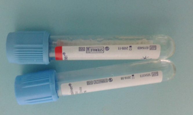 ΠΟΕΔΗΝ: Ζητεί την παρέμβαση Εισαγγελέα για ληγμένα υλικά στο Σισμανόγλειο