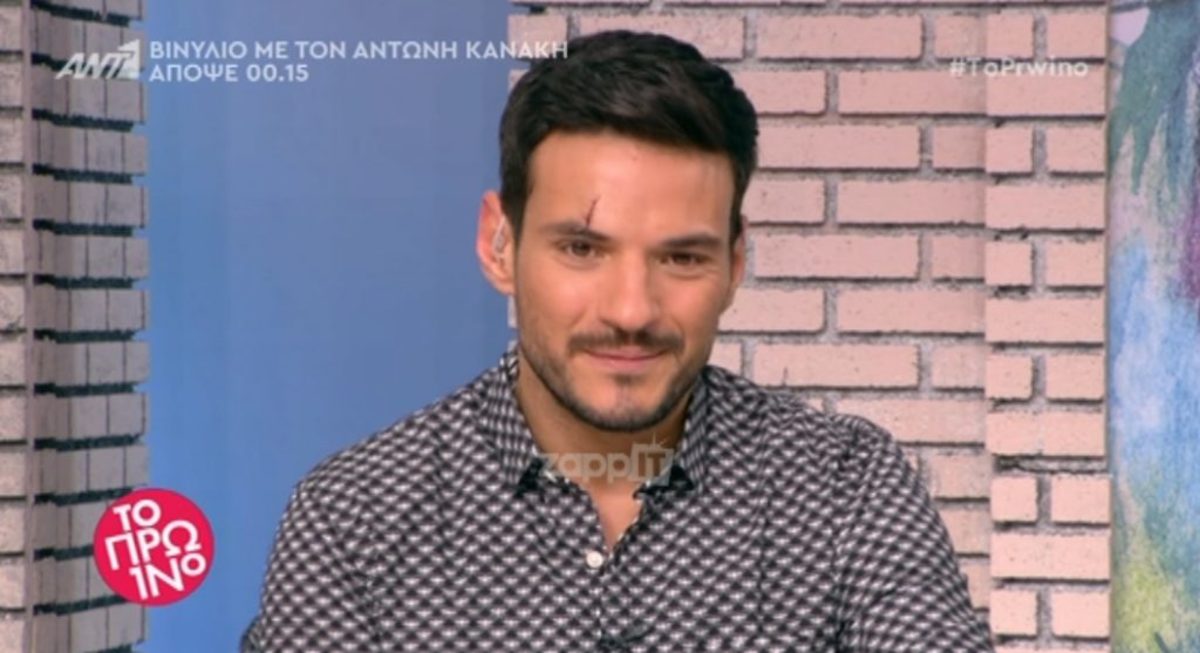 Με ράμματα στο μέτωπο ο Κώστας Τσουρός στο Πρωινό!