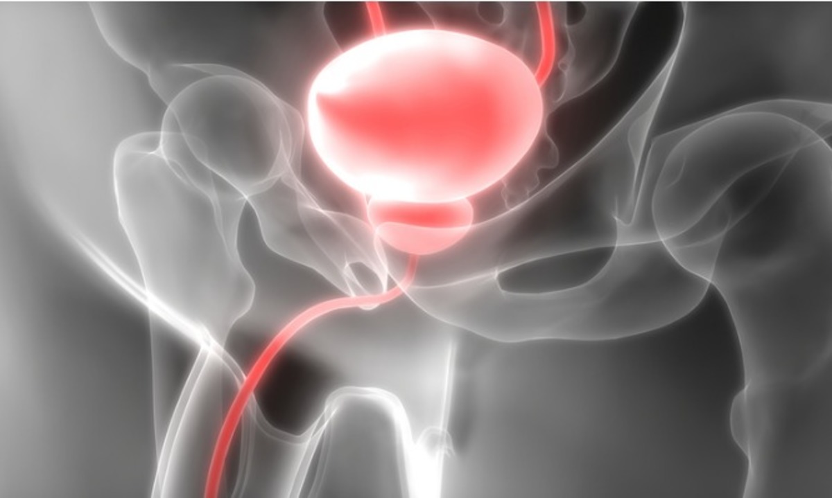 Από ποια ηλικία και κάθε πότε πρέπει να κάνετε εξέταση προστάτη