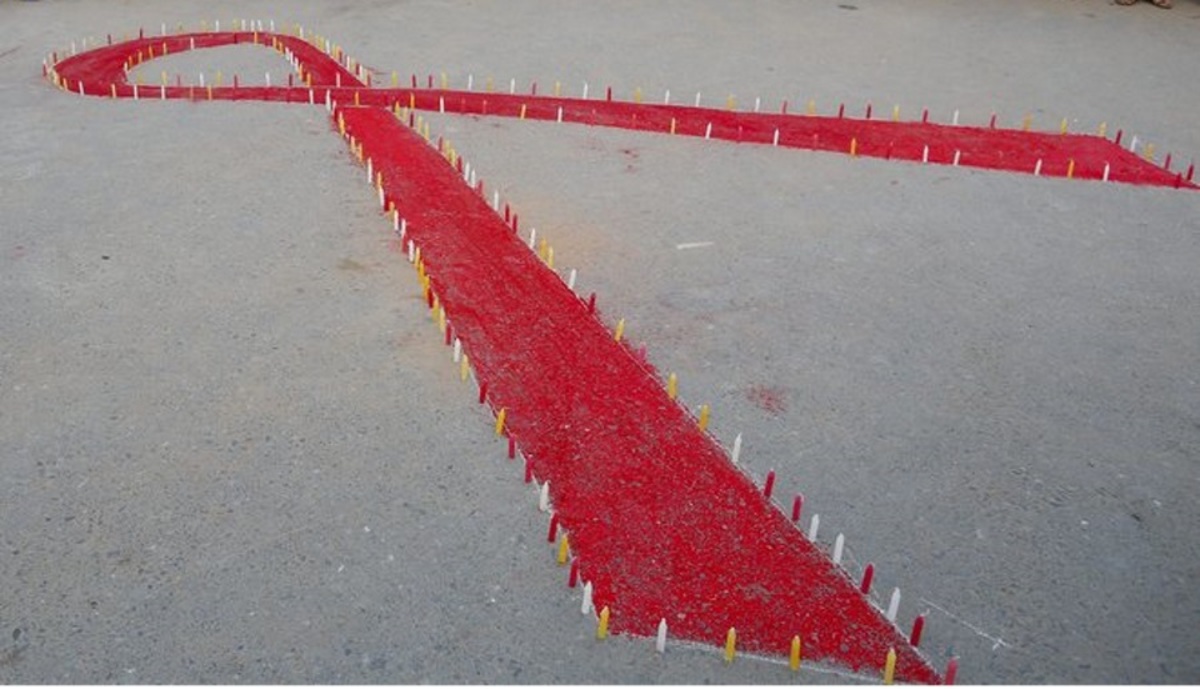 HIV