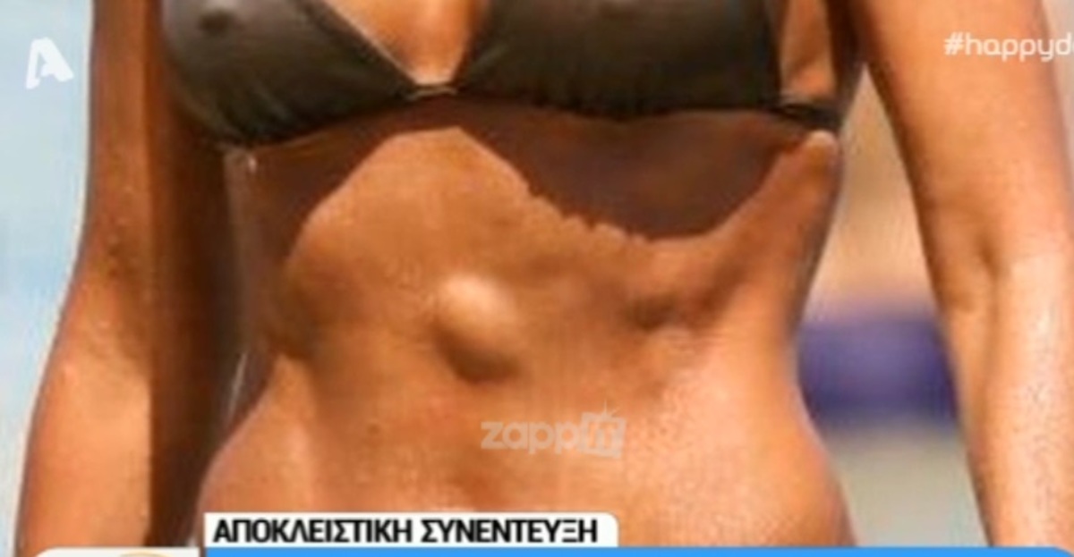 Η Σόφη Πασχάλη εξηγεί τι είναι το σημάδι στην κοιλιά της