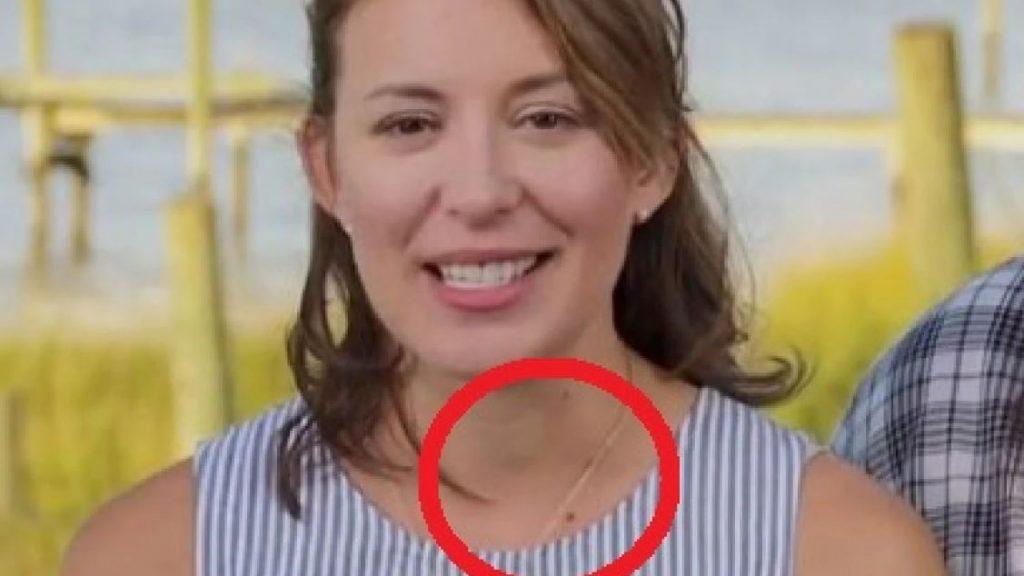 Γιατρός είδε ΑΥΤΟ σε γυναίκα που ήταν στην TV και την έσωσε από καρκίνο – Το βλέπετε; [vid]