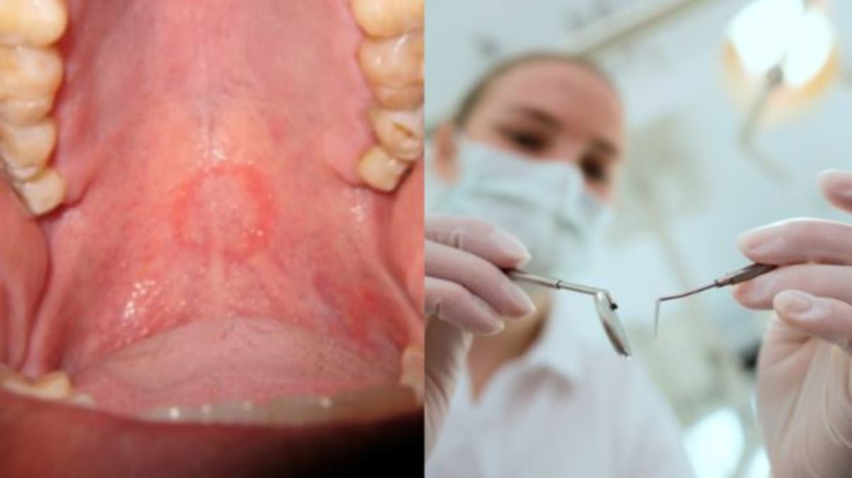 Βλέπετε το σημάδι στον ουρανίσκο του; Το έπαθε από το στοματικό σεξ!