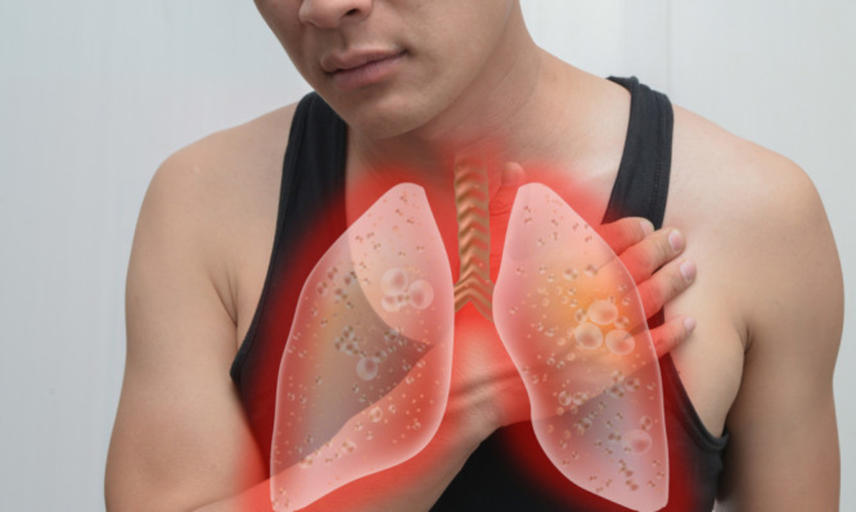 Καρκίνος του πνεύμονα και βήχας: Ποια είναι η σύνδεση!