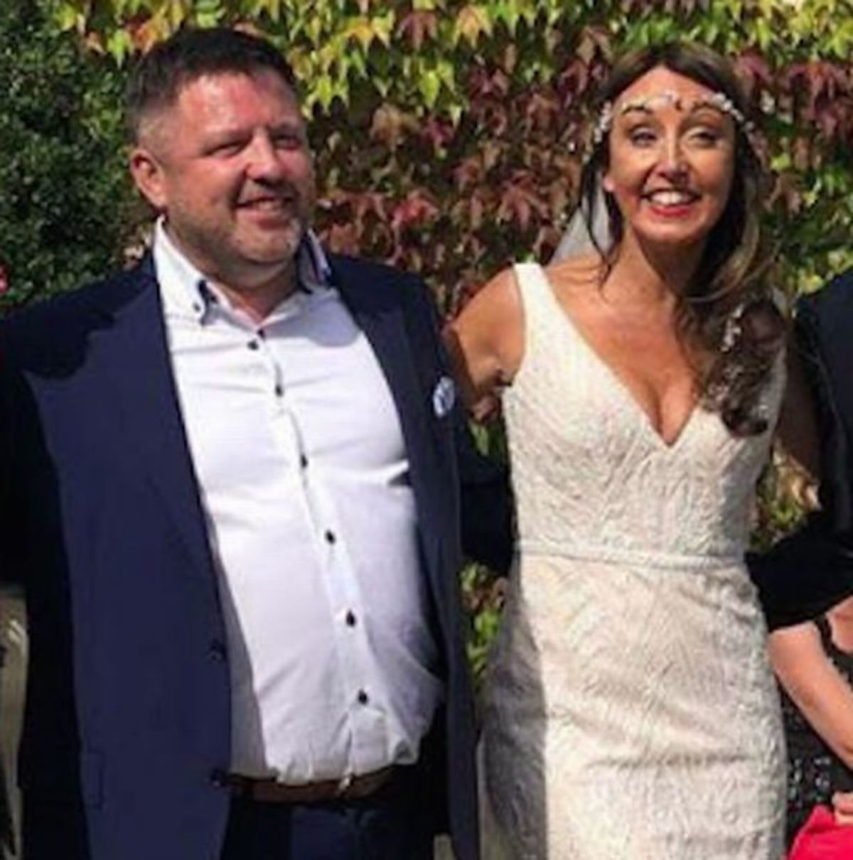 Φωτιά Αττική: Νεκρός ο Ιρλανδός, με σοβαρά εγκαύματα η νύφη – Τραγικό φινάλε στο γαμήλιο ταξίδι