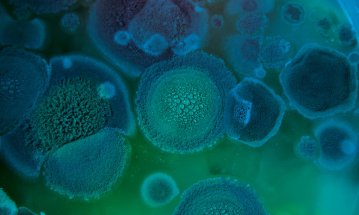 Παιδιά στη Ταϊλάνδη: Μετά τη διάσωση πρέπει να διαπιστωθεί αν πάσχουν από τη Νόσο των Σπηλαίων