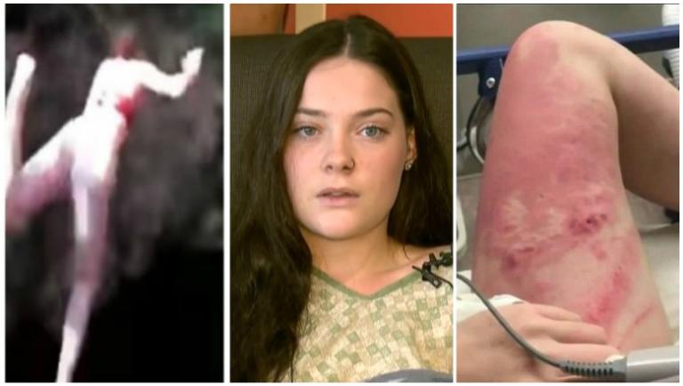 "Θα μπορούσα να πεθάνω" λέει η 16χρονη που βρέθηκε στο κενό! Σπασμένα πλευρά και σοκαριστικές εικόνες από το νοσοκομείο! video