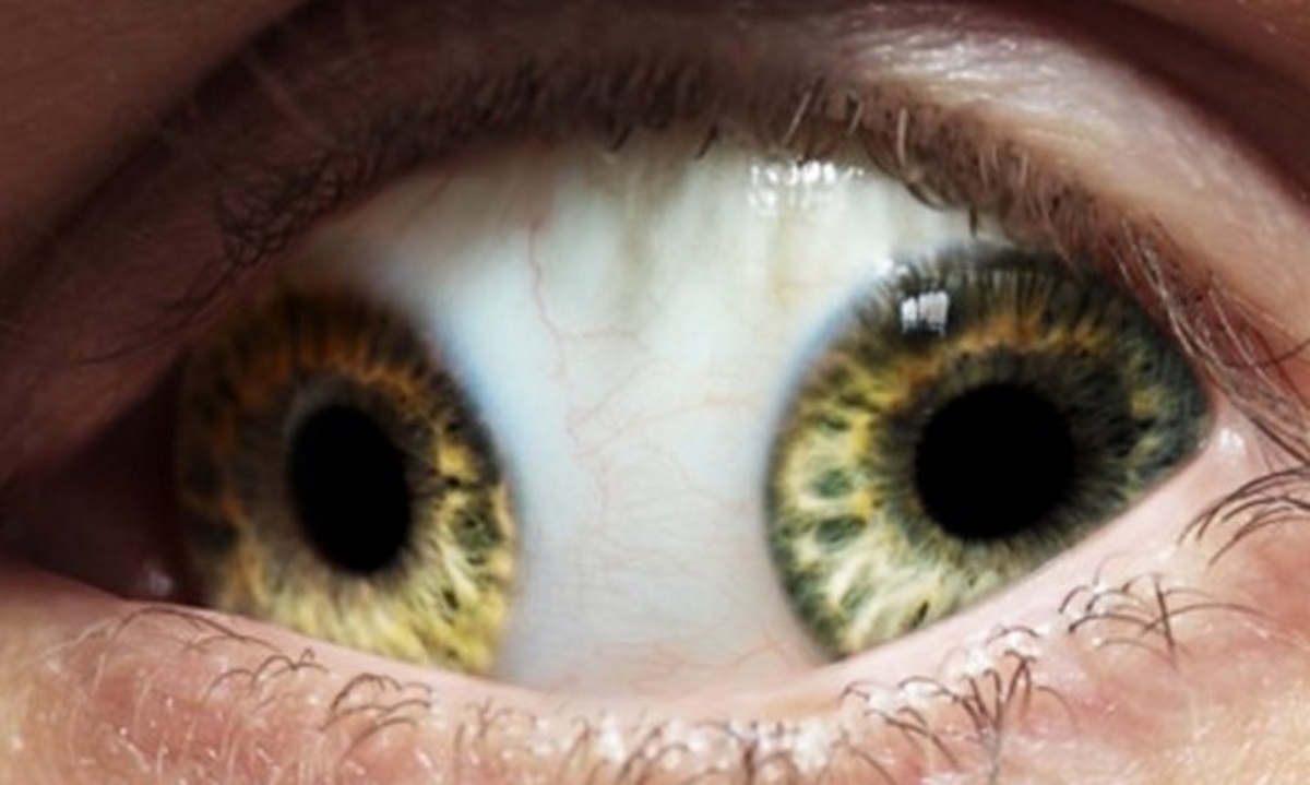 Οι δέκα πιο παράξενες ασθένειες στην ιστορία της Ιατρικής