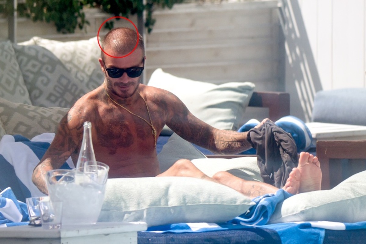 Oops! Ο David Beckham με… ελάχιστα μαλλιά! Χαμός με τις φωτογραφίες του Βρετανού γόη