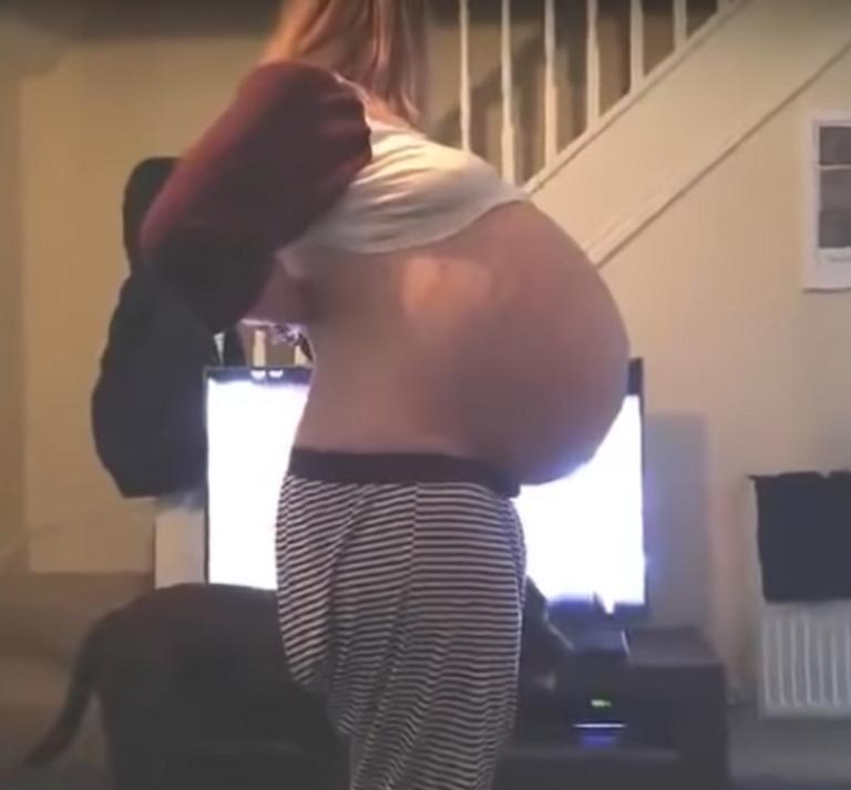 Περίεργο! Νόμιζε ότι ήταν έγκυος, αλλά...! [pics, Video]