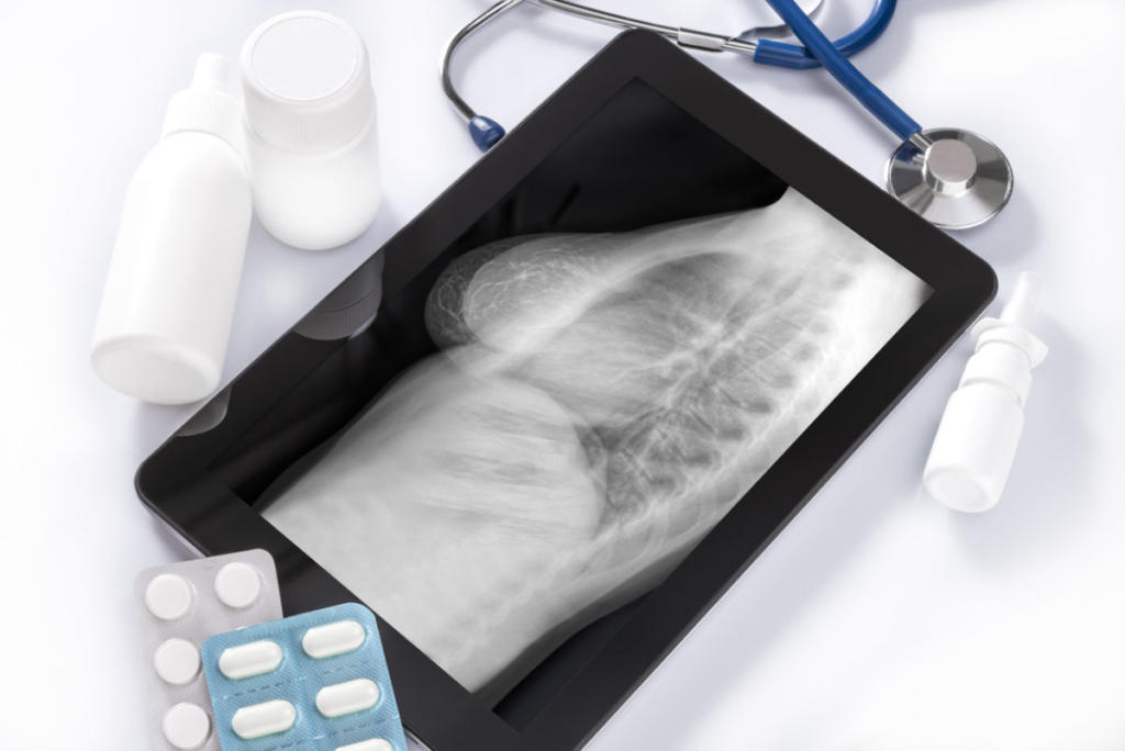 Καρκίνος του μαστού: Ποιο είδος μαστογραφίας οδηγεί σε πιο ασφαλή διάγνωση