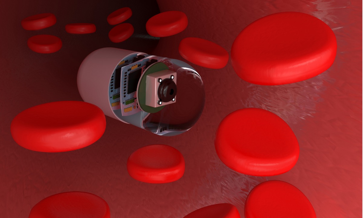 Δημιούργησαν “ηλεκτρονικό χάπι” που το καταπίνεις, συνδέεται με το κινητό και σου λέει τι έχεις!