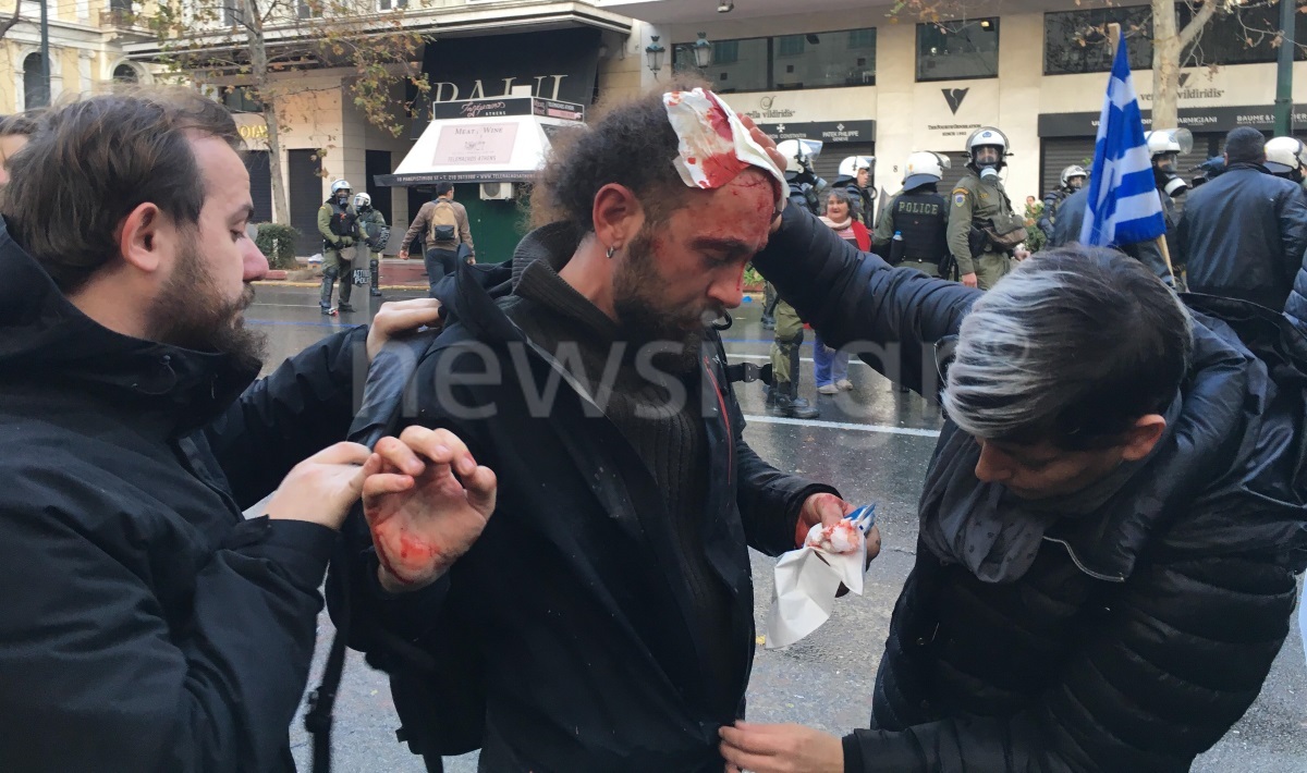 Χτύπησαν φωτορεπόρτερ και του έκλεψαν και τον εξοπλισμό!