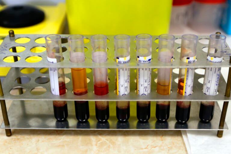 ΚΕΕΛΠΝΟ – γρίπη: Αυτές είναι οι οδηγίες για την αντιμετώπιση της έξαρσης | Newsit.gr ΚΕΕΛΠΝΟ – γρίπη: Αυτές είναι οι οδηγίες για την αντιμετώπιση της έξαρσης | Newsit.gr