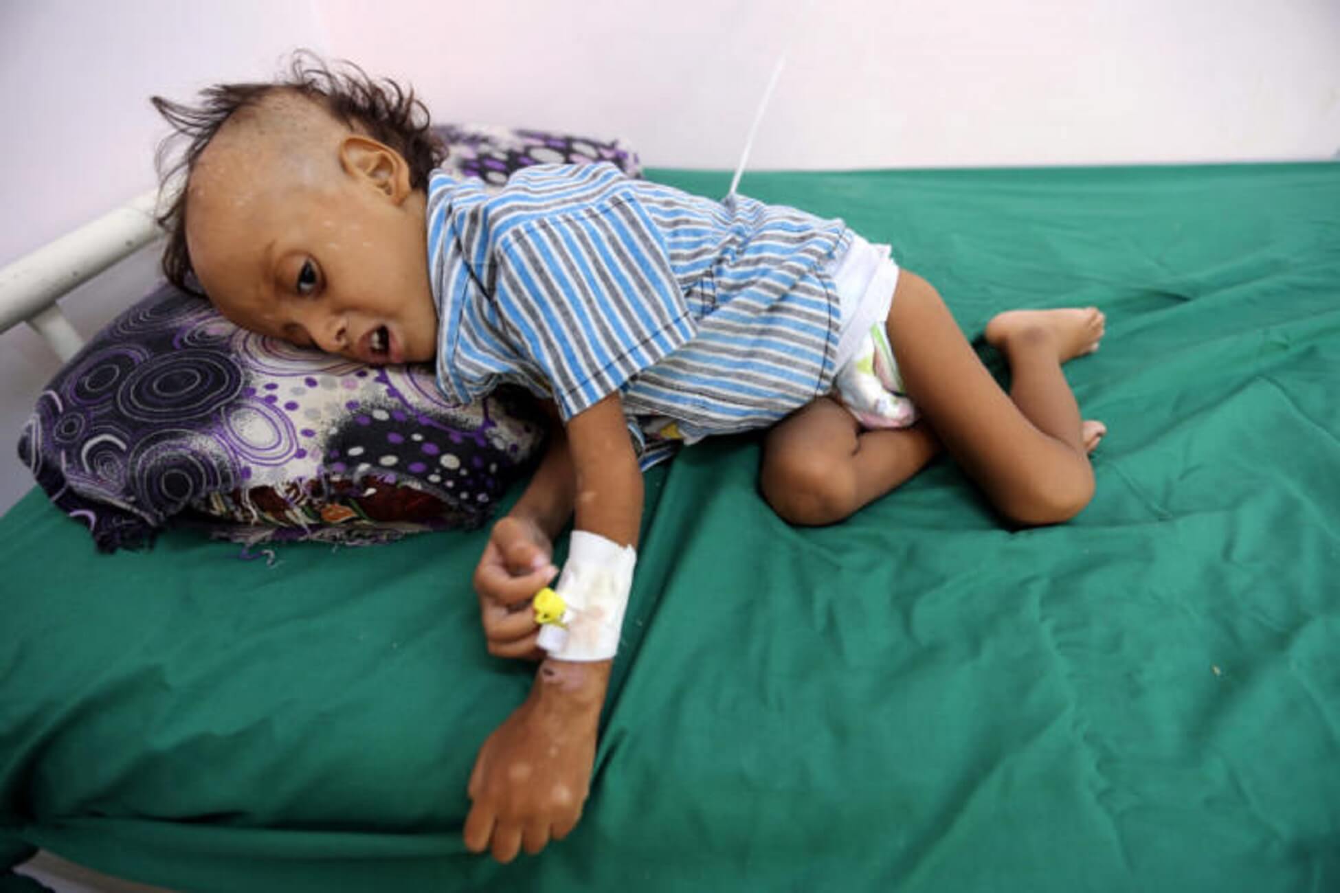 Υεμένη, ώρα μηδέν – Δραματική ανακοίνωση του ΟΗΕ για τη «χειρότερη ανθρωπιστική κρίση στον κόσμο»