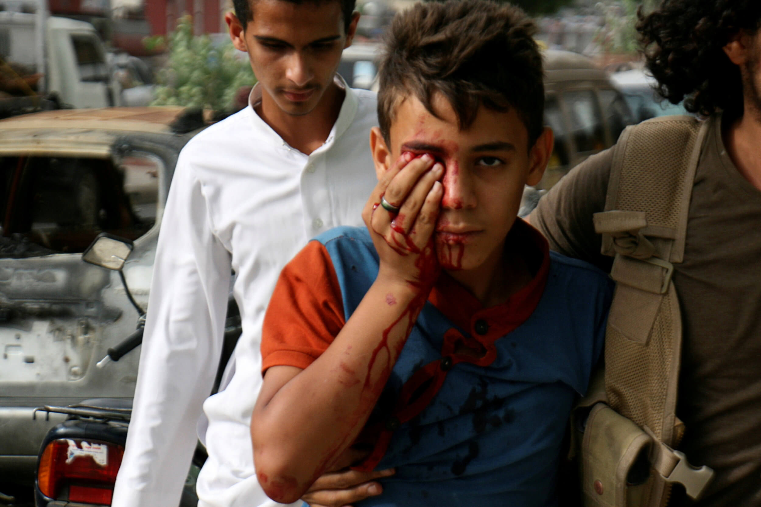 Υεμένη: Νεκροί άμαχοι από πύραυλο δίπλα σε νοσοκομείο