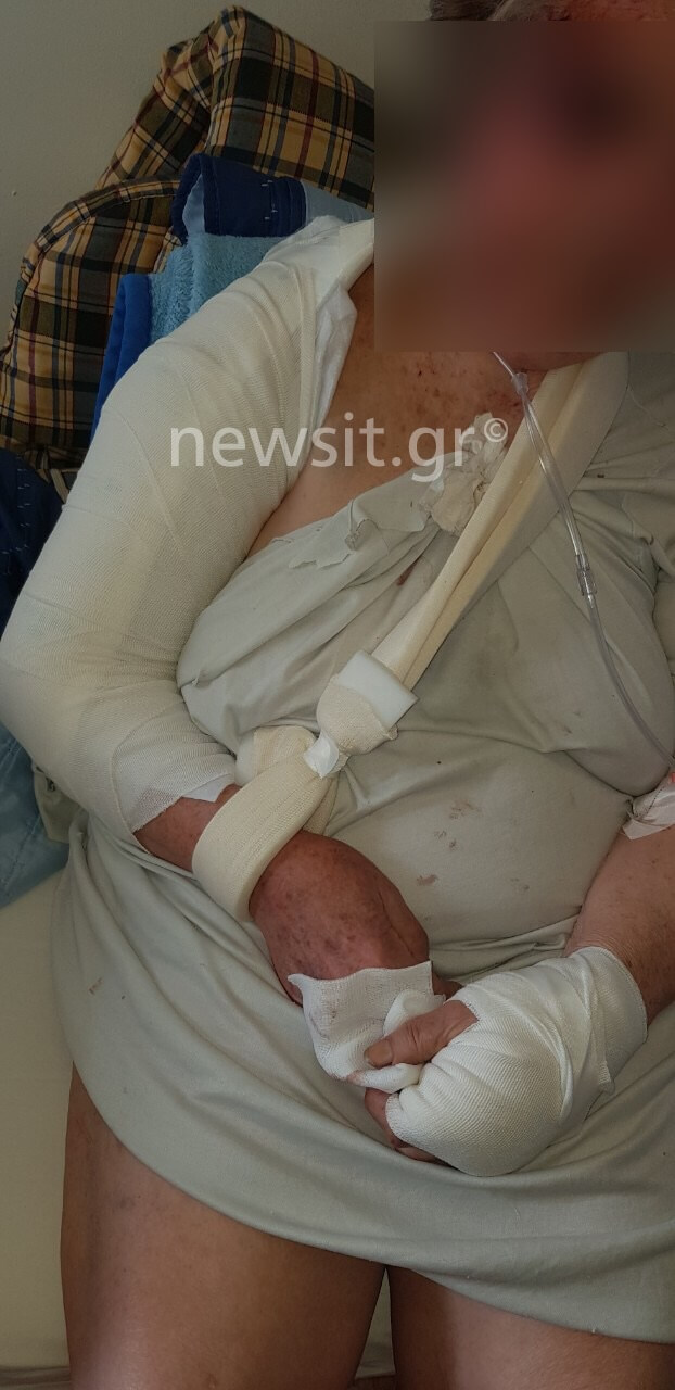 Εικόνες σοκ: Αυτή είναι η 84χρονη που δέχτηκε επίθεση στο Παγκράτι