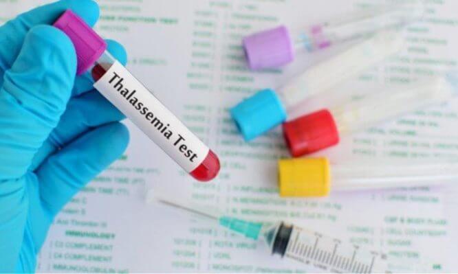 Ελπίδες οριστικής θεραπείας από τη Μεσογειακή Αναιμία δίνει η περίπτωση Έλληνα ασθενή