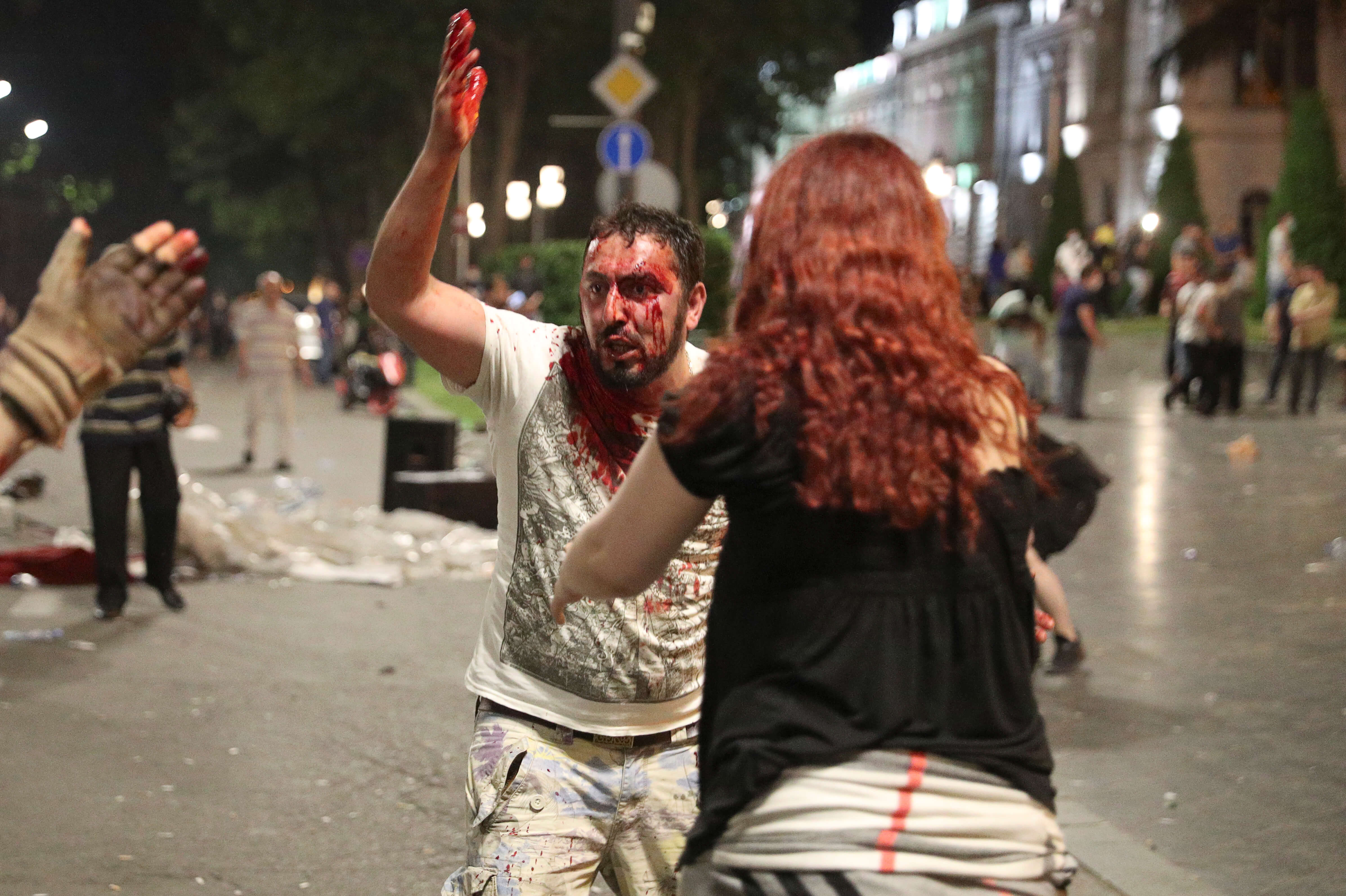 Γεωργία: Πεδίο μάχης έξω από το κοινοβούλιο – Δεκάδες τραυματίες [video, pics]