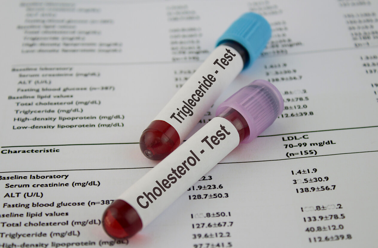 Τι είναι τα τριγλυκερίδια και τι συμβαίνει με την χοληστερίνη – Τιμές και όρια