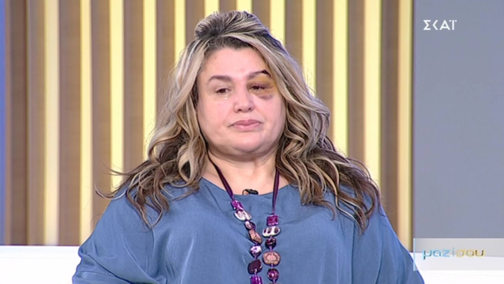 Όλα όσα λέει η Μπίλι Τζόε για τον ξυλοδαρμό της – Γιατί ανακάλεσε τη μήνυση σε βάρος του 39χρονου;